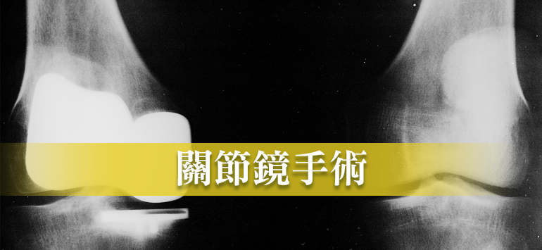 関節鏡視下手術