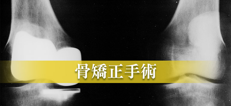 骨矯正手術