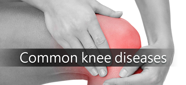 common-knee-diseases